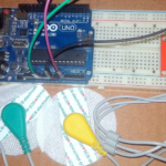 Monitoramento de gráfico de ECG com sensor de ECG AD8232 com Arduino